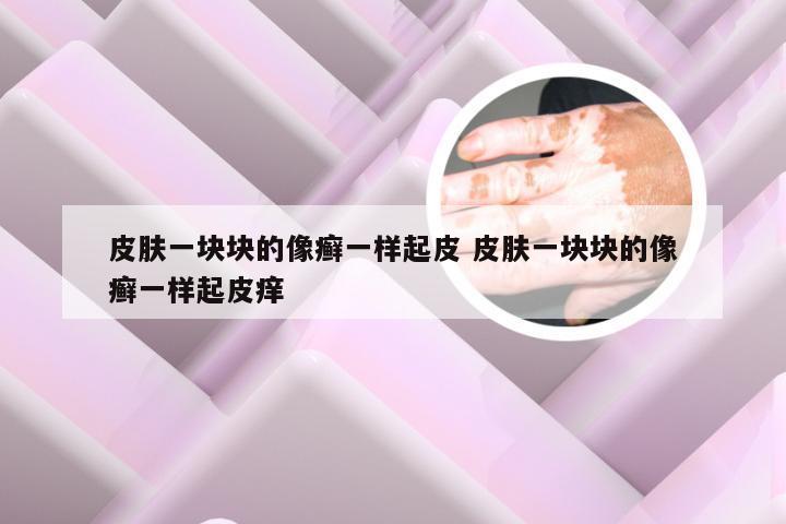 皮肤一块块的像癣一样起皮 皮肤一块块的像癣一样起皮痒