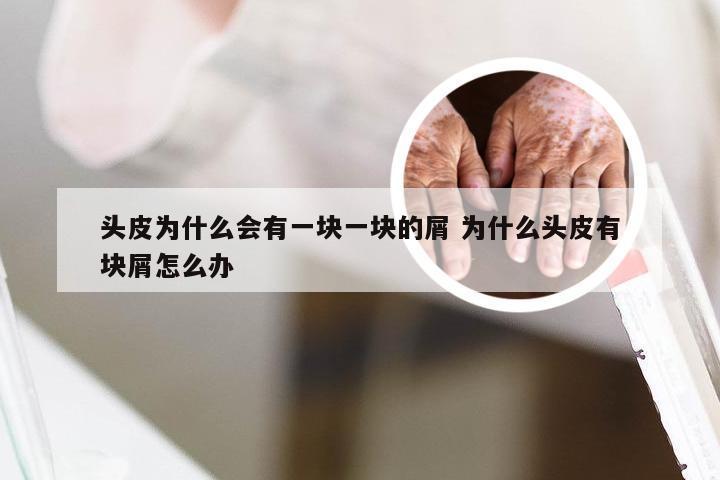 头皮为什么会有一块一块的屑 为什么头皮有块屑怎么办