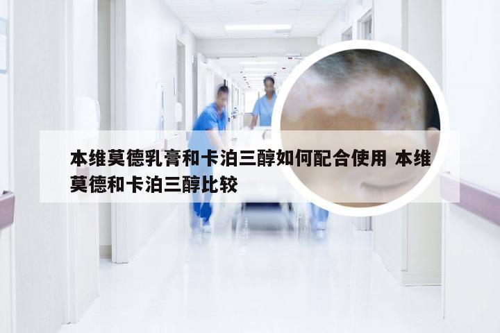 本维莫德乳膏和卡泊三醇如何配合使用 本维莫德和卡泊三醇比较