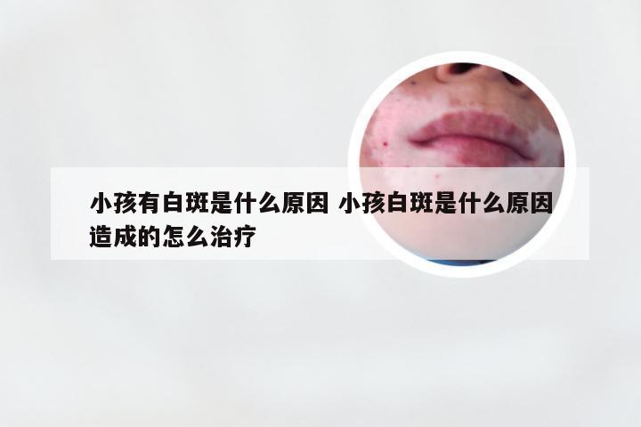 小孩有白斑是什么原因 小孩白斑是什么原因造成的怎么治疗