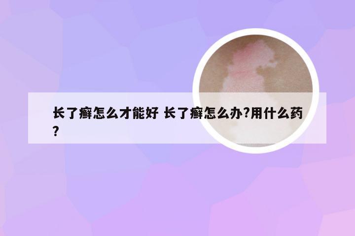 长了癣怎么才能好 长了癣怎么办?用什么药?