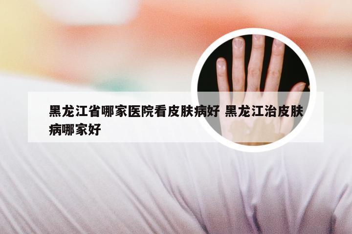 黑龙江省哪家医院看皮肤病好 黑龙江治皮肤病哪家好