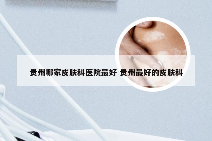 贵州哪家皮肤科医院最好 贵州最好的皮肤科