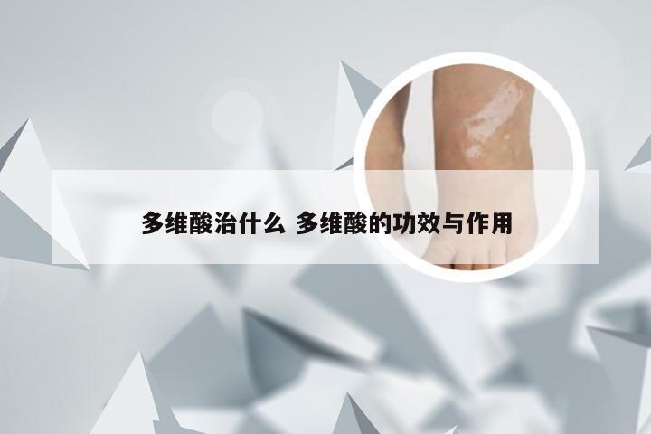 多维酸治什么 多维酸的功效与作用
