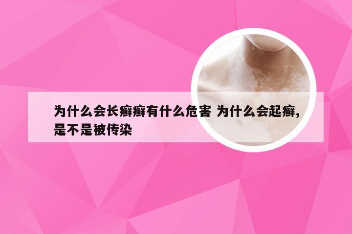 为什么会长癣癣有什么危害 为什么会起癣,是不是被传染