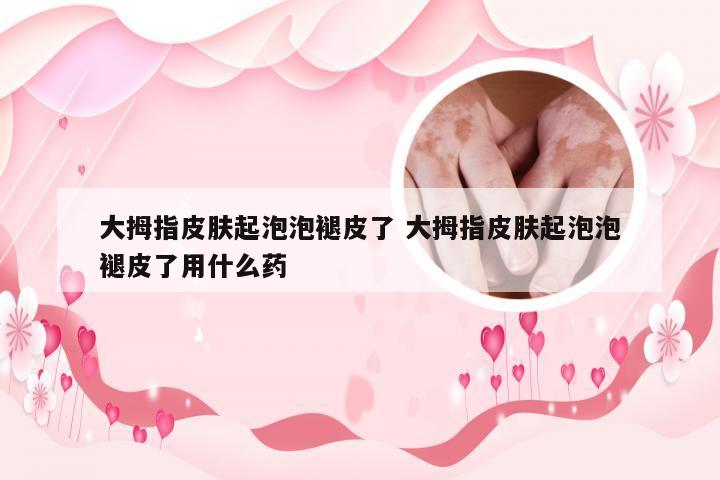 大拇指皮肤起泡泡褪皮了 大拇指皮肤起泡泡褪皮了用什么药