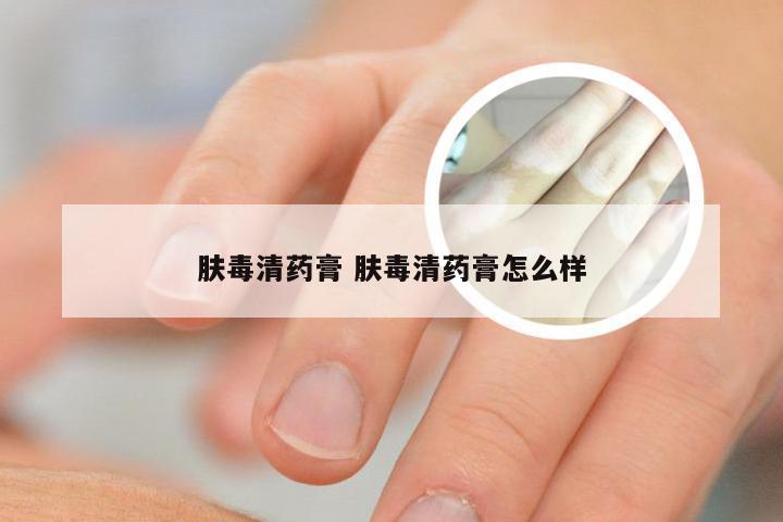 肤毒清药膏 肤毒清药膏怎么样