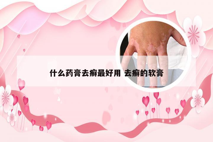 什么药膏去癣最好用 去癣的软膏