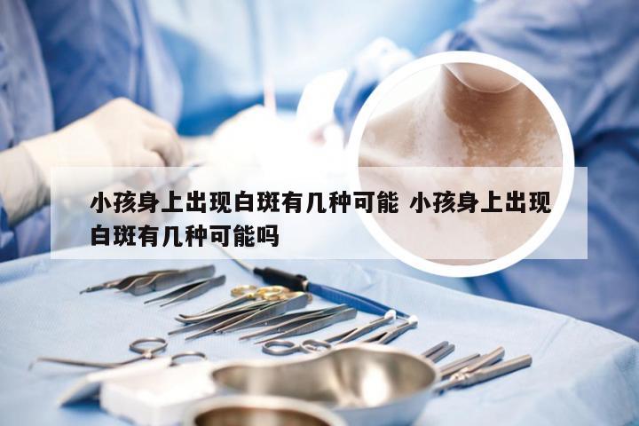 小孩身上出现白斑有几种可能 小孩身上出现白斑有几种可能吗