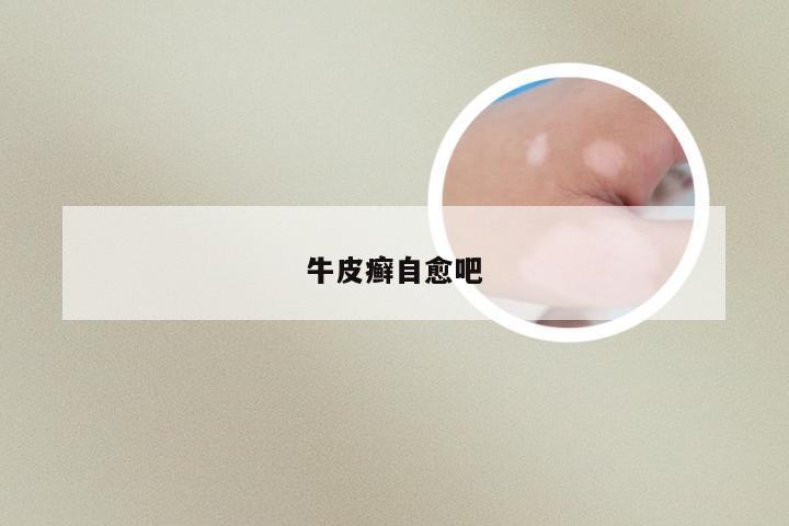 牛皮癣自愈吧