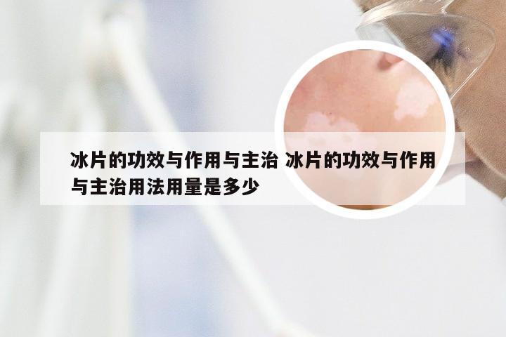 冰片的功效与作用与主治 冰片的功效与作用与主治用法用量是多少