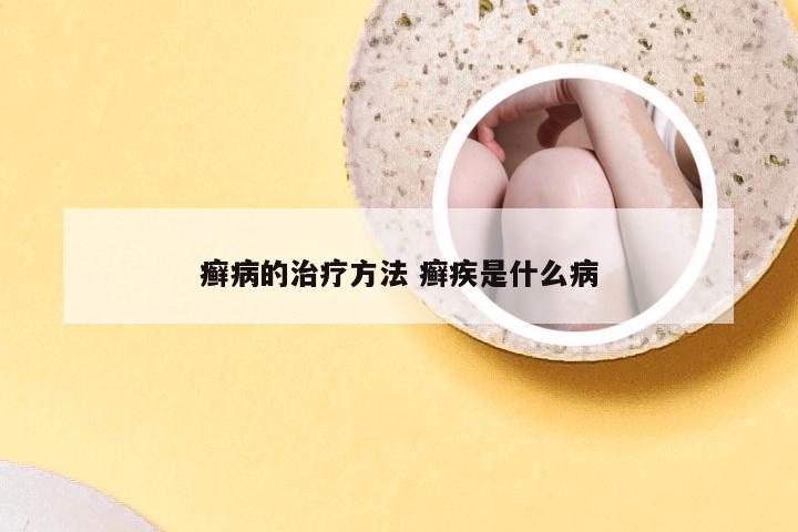 癣病的治疗方法 癣疾是什么病