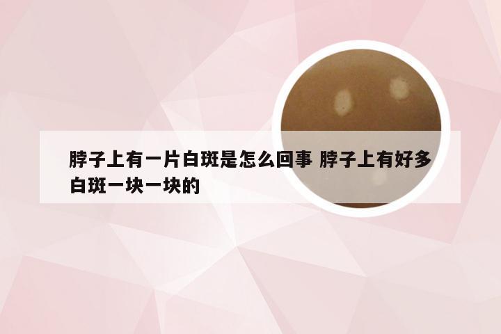 脖子上有一片白斑是怎么回事 脖子上有好多白斑一块一块的