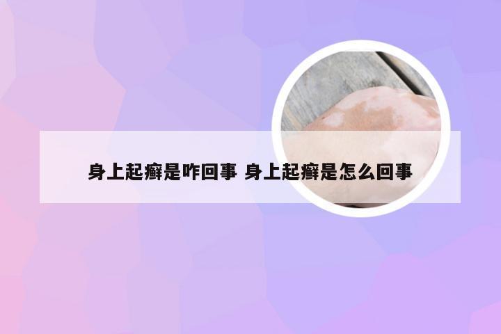 身上起癣是咋回事 身上起癣是怎么回事