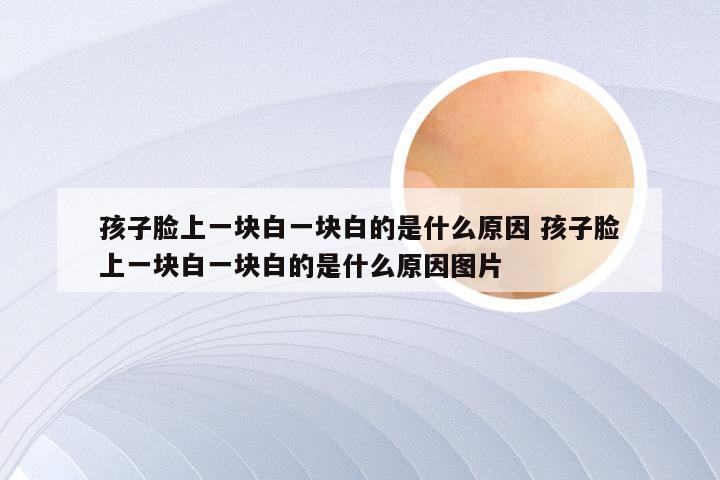 孩子脸上一块白一块白的是什么原因 孩子脸上一块白一块白的是什么原因图片