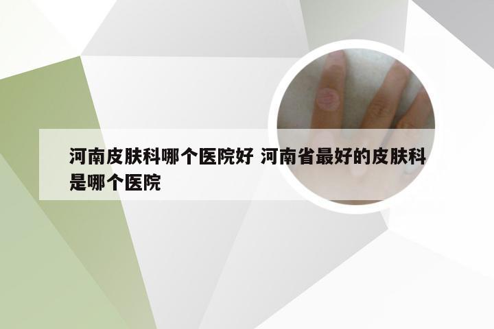 河南皮肤科哪个医院好 河南省最好的皮肤科是哪个医院