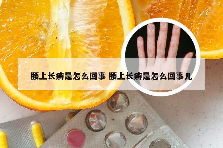 腰上长癣是怎么回事 腰上长癣是怎么回事儿