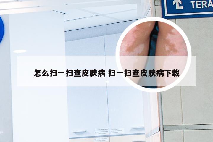 怎么扫一扫查皮肤病 扫一扫查皮肤病下载
