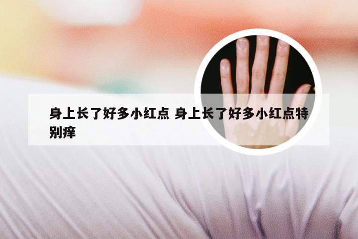 身上长了好多小红点 身上长了好多小红点特别痒