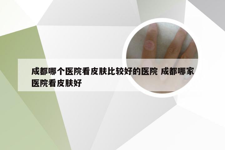 成都哪个医院看皮肤比较好的医院 成都哪家医院看皮肤好