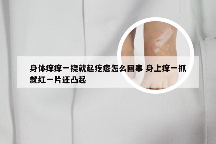 身体痒痒一挠就起疙瘩怎么回事 身上痒一抓就红一片还凸起