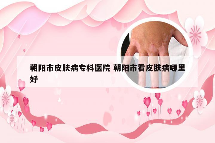 朝阳市皮肤病专科医院 朝阳市看皮肤病哪里好