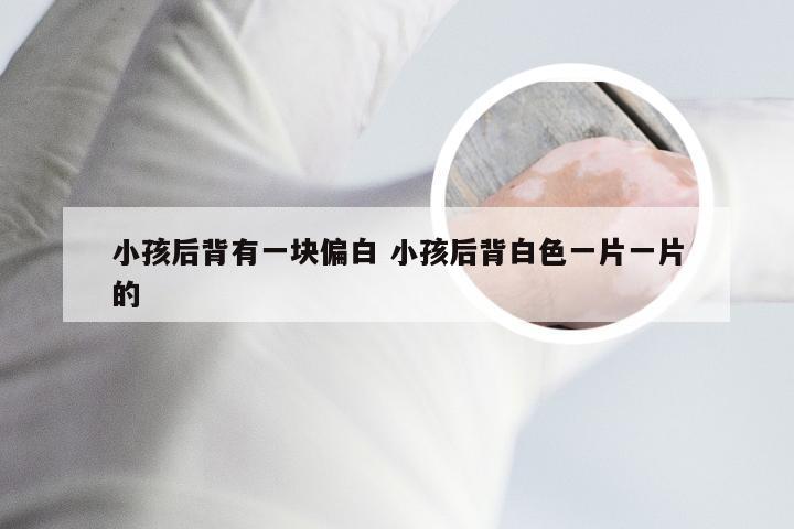 小孩后背有一块偏白 小孩后背白色一片一片的