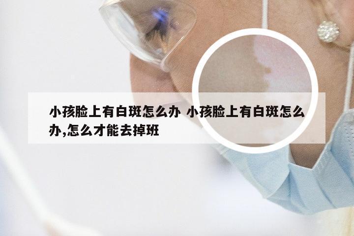 小孩脸上有白斑怎么办 小孩脸上有白斑怎么办,怎么才能去掉班