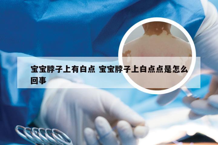 宝宝脖子上有白点 宝宝脖子上白点点是怎么回事