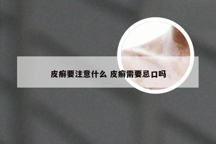 皮癣要注意什么 皮癣需要忌口吗