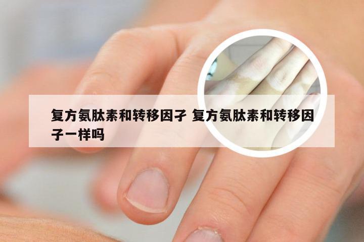 复方氨肽素和转移因孑 复方氨肽素和转移因子一样吗