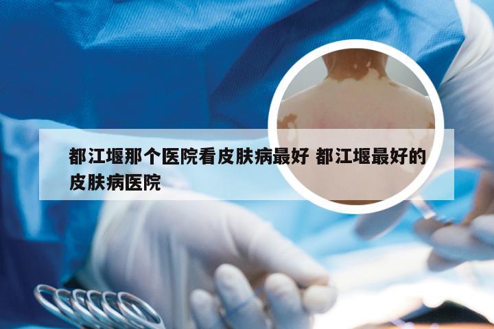 都江堰那个医院看皮肤病最好 都江堰最好的皮肤病医院