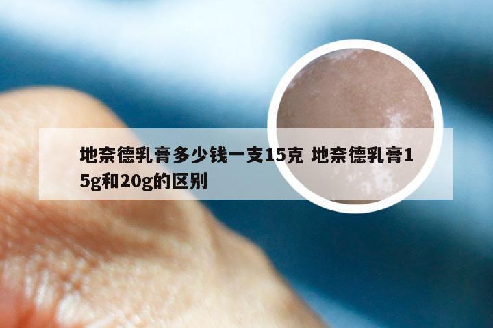 地奈德乳膏多少钱一支15克 地奈德乳膏15g和20g的区别
