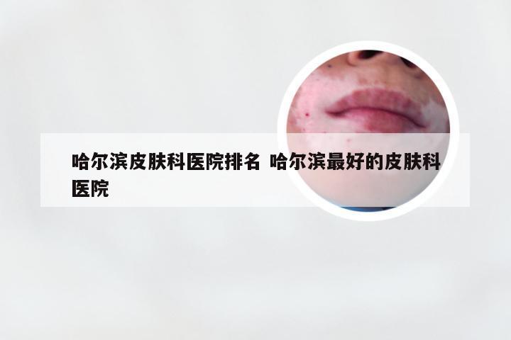 哈尔滨皮肤科医院排名 哈尔滨最好的皮肤科医院