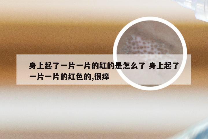 身上起了一片一片的红的是怎么了 身上起了一片一片的红色的,很痒