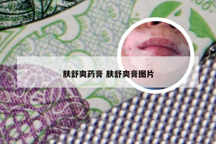 肤舒爽药膏 肤舒爽膏图片