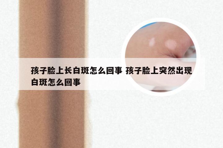 孩子脸上长白斑怎么回事 孩子脸上突然出现白斑怎么回事