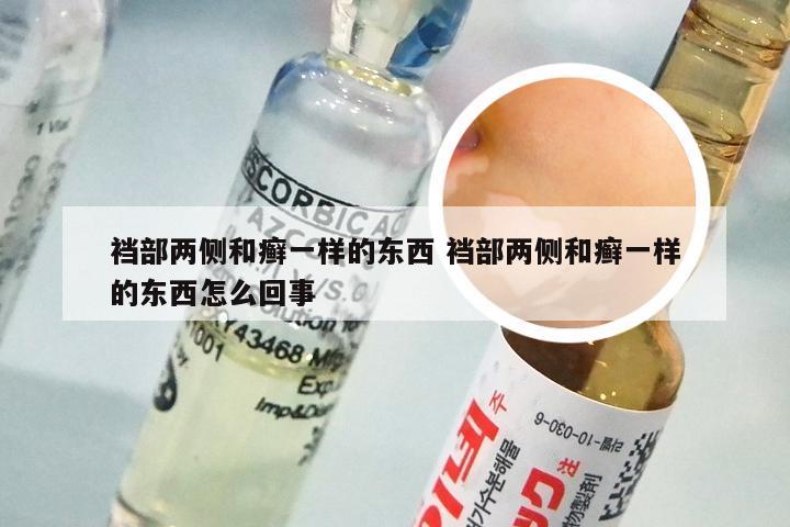 裆部两侧和癣一样的东西 裆部两侧和癣一样的东西怎么回事