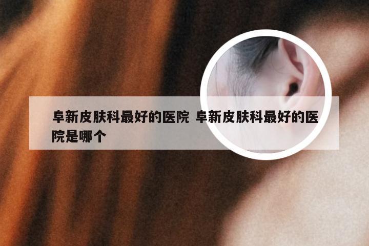 阜新皮肤科最好的医院 阜新皮肤科最好的医院是哪个