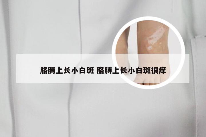胳膊上长小白斑 胳膊上长小白斑很痒