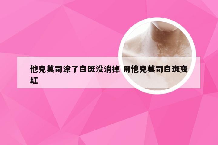 他克莫司涂了白斑没消掉 用他克莫司白斑变红