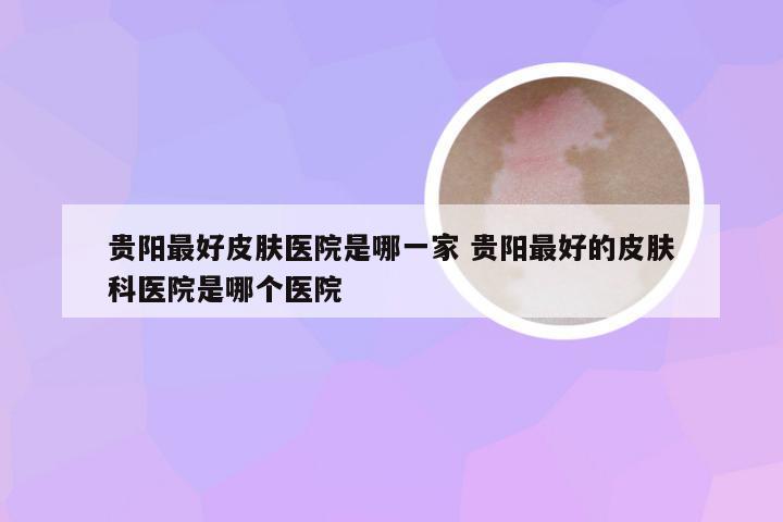 贵阳最好皮肤医院是哪一家 贵阳最好的皮肤科医院是哪个医院