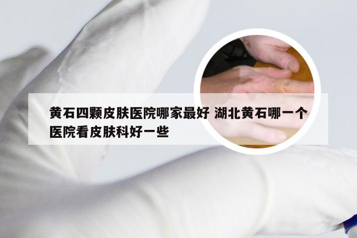 黄石四颗皮肤医院哪家最好 湖北黄石哪一个医院看皮肤科好一些
