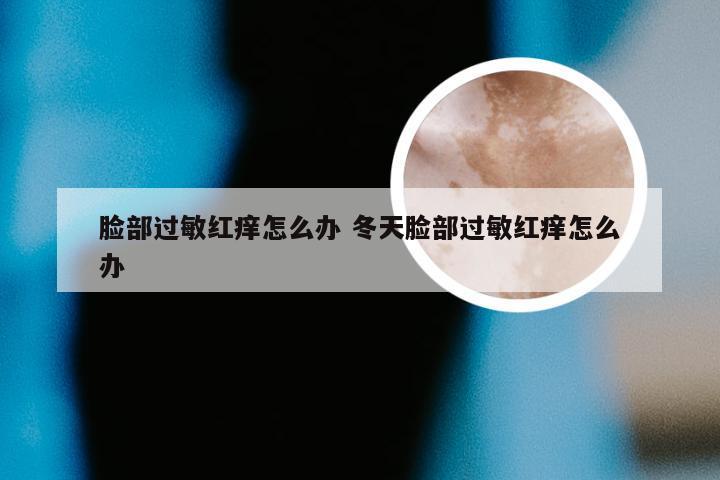 脸部过敏红痒怎么办 冬天脸部过敏红痒怎么办