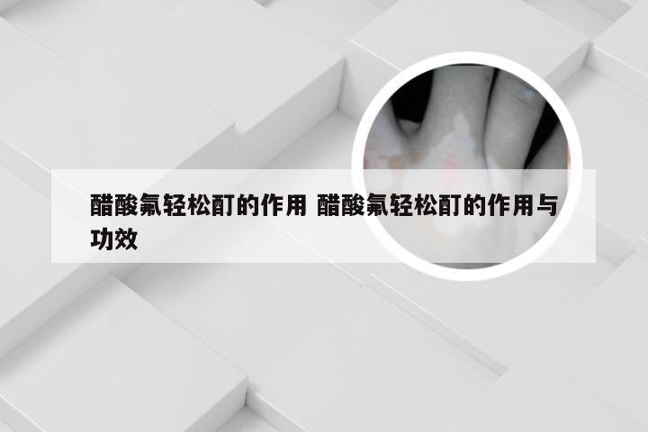 醋酸氟轻松酊的作用 醋酸氟轻松酊的作用与功效