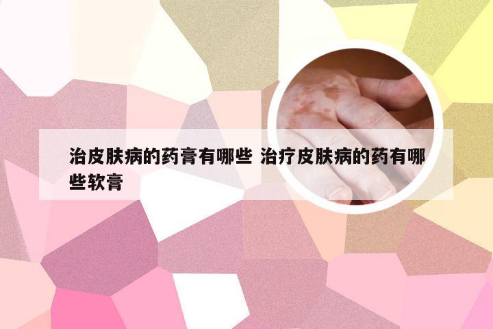 治皮肤病的药膏有哪些 治疗皮肤病的药有哪些软膏