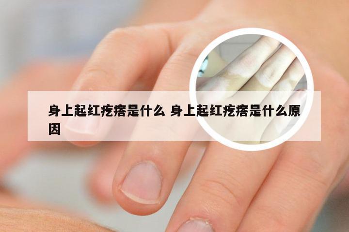 身上起红疙瘩是什么 身上起红疙瘩是什么原因