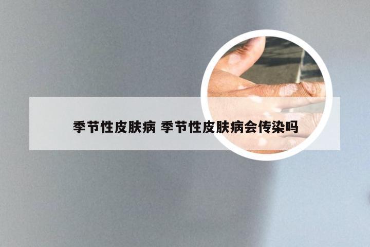 季节性皮肤病 季节性皮肤病会传染吗