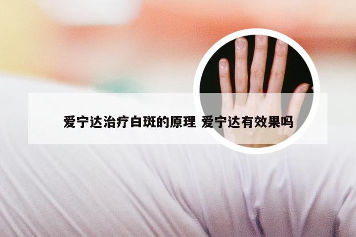 爱宁达治疗白斑的原理 爱宁达有效果吗