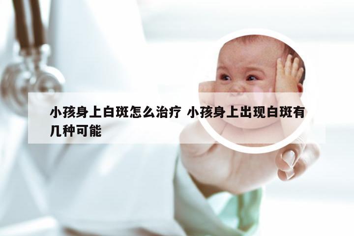 小孩身上白斑怎么治疗 小孩身上出现白斑有几种可能